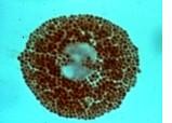 Eosinofili-mastociti: il binomio interattivo della risposta ritardata allergica