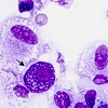 PEA, mastociti ed atopia: una triade indissolubile