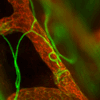 PEA nell’infiammazione cutanea cronica