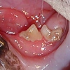 Malattia parodontale: dalla bocca al cuore… e non solo