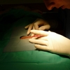 Controllare il mastocita per migliorare la cicatrizzazione post-chirurgica