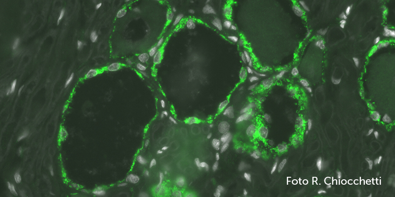 Scoperti nei gangli spinali di cane i recettori per gli endocannabinoidi