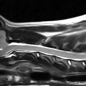 In caso di dolore neuropatico lombo-sacrale