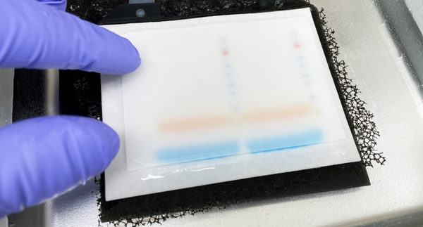 Glomerulare o tubulare? La proteinuria nel paziente canino